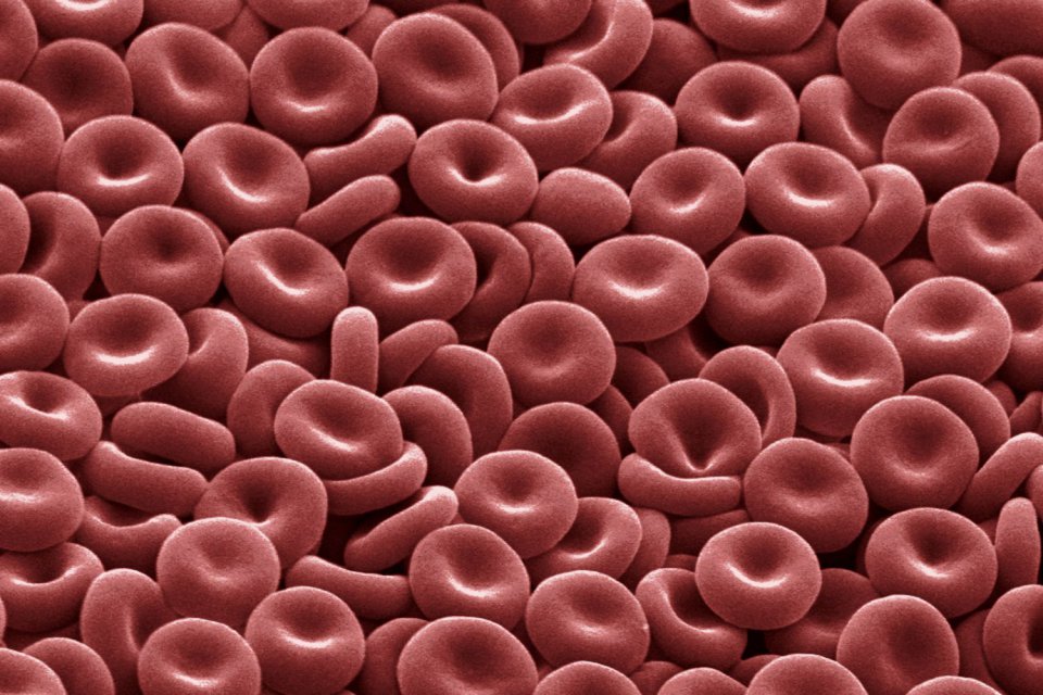 red_blood_cells_1-57b20c583df78cd39c2f8e15.jpg
